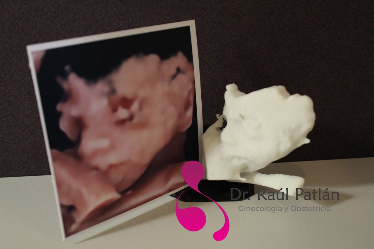 Dr. Raul Alejandro Patlan Montalvo — foto 3
