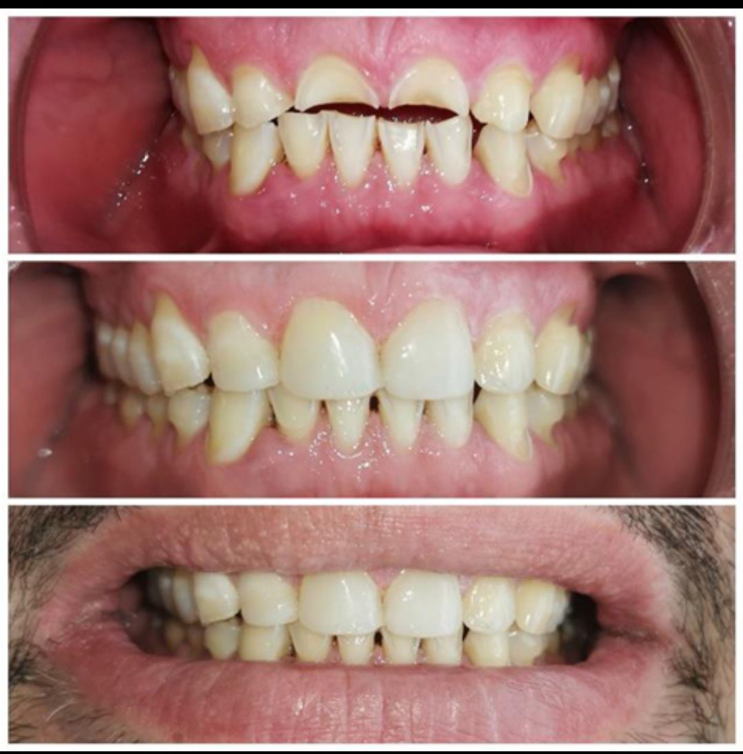 Endodoncista