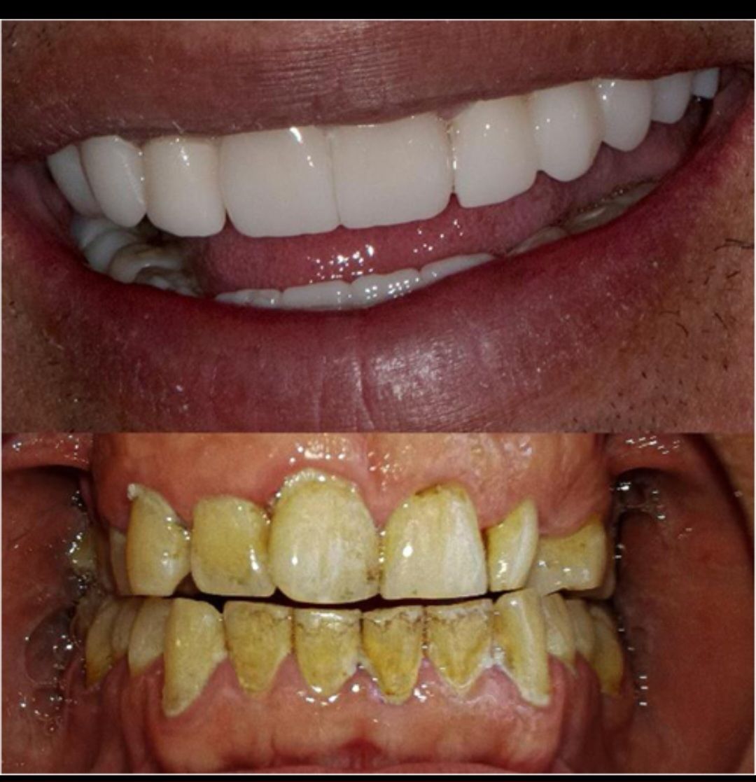 Endodoncista — foto 2