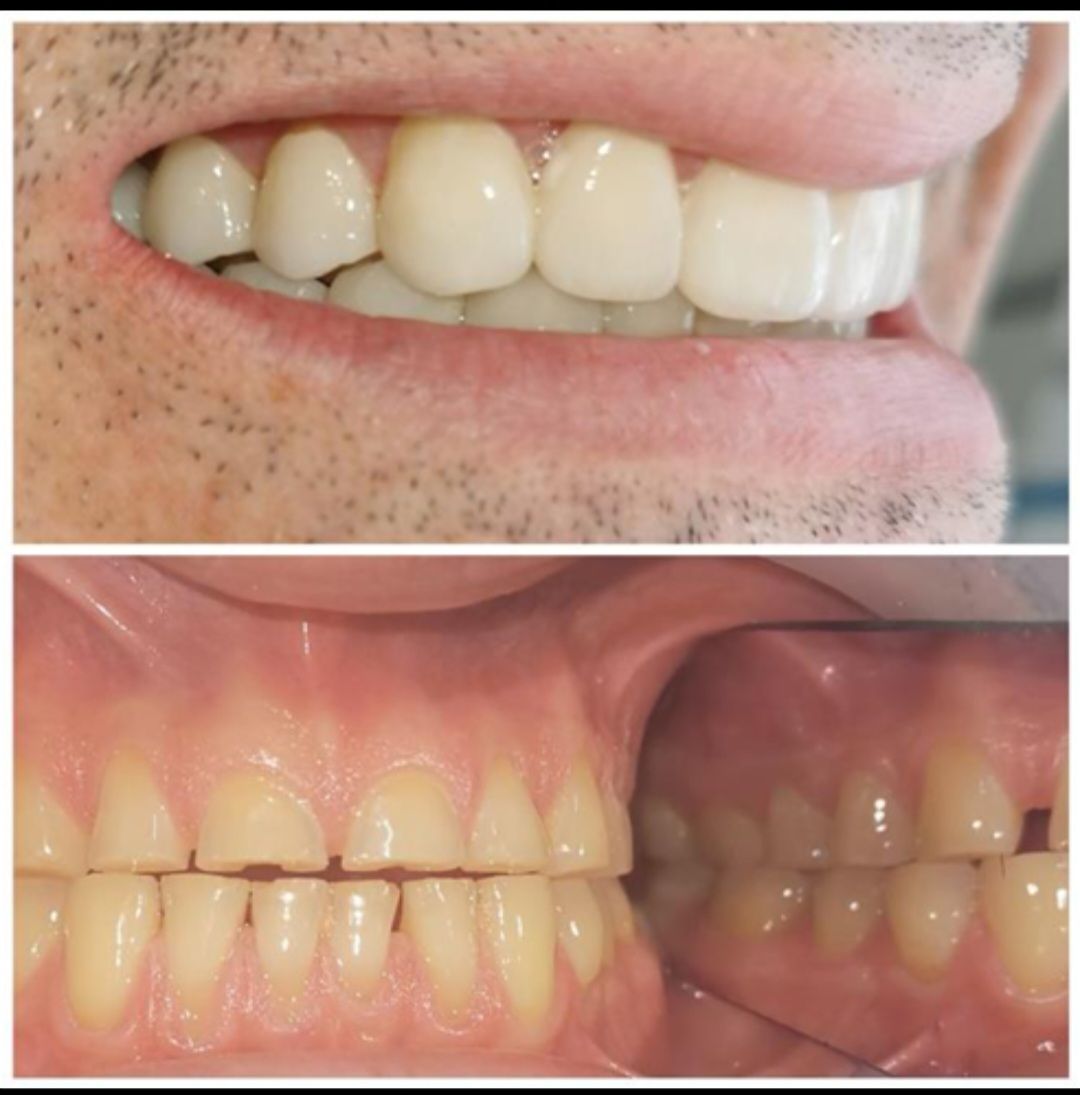 Endodoncista — foto 3