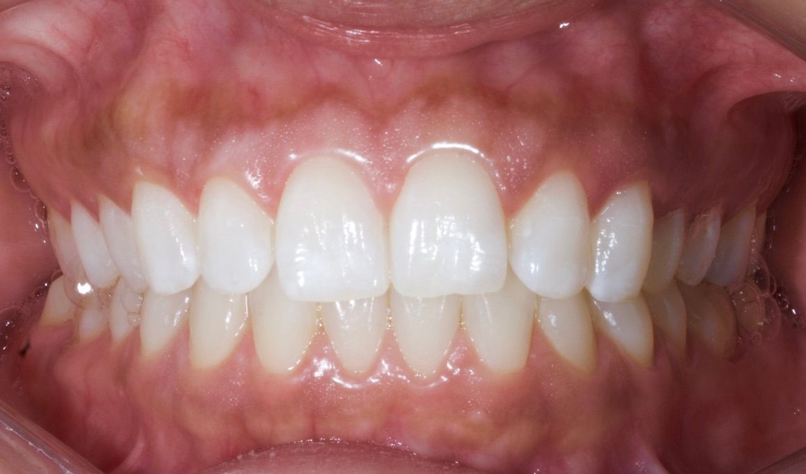 Blinken dental studio