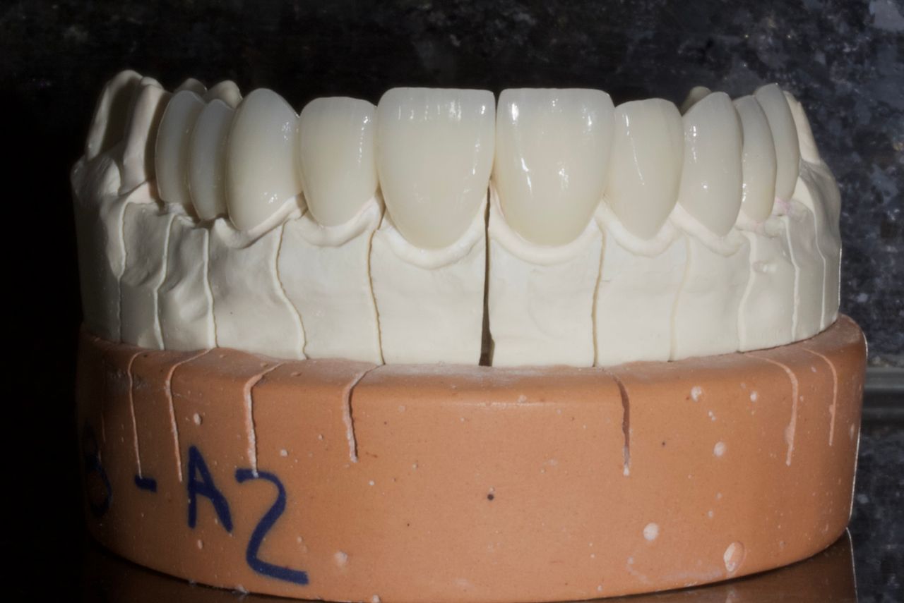Blinken dental studio — foto 3