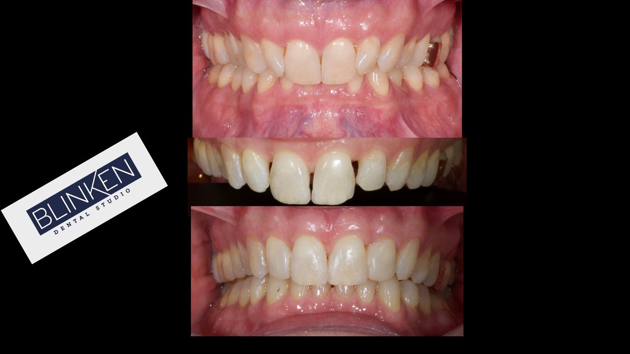 Blinken dental studio — foto 4
