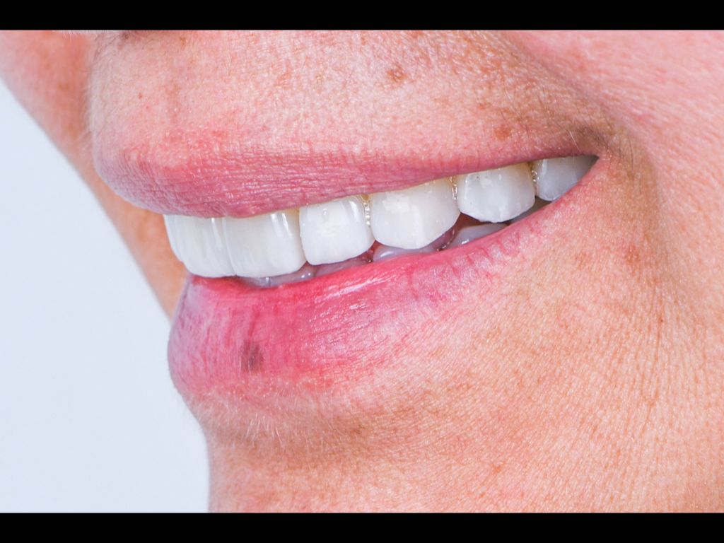 Ricardo Lemus Dental Studio Hospital Angeles — foto 2
