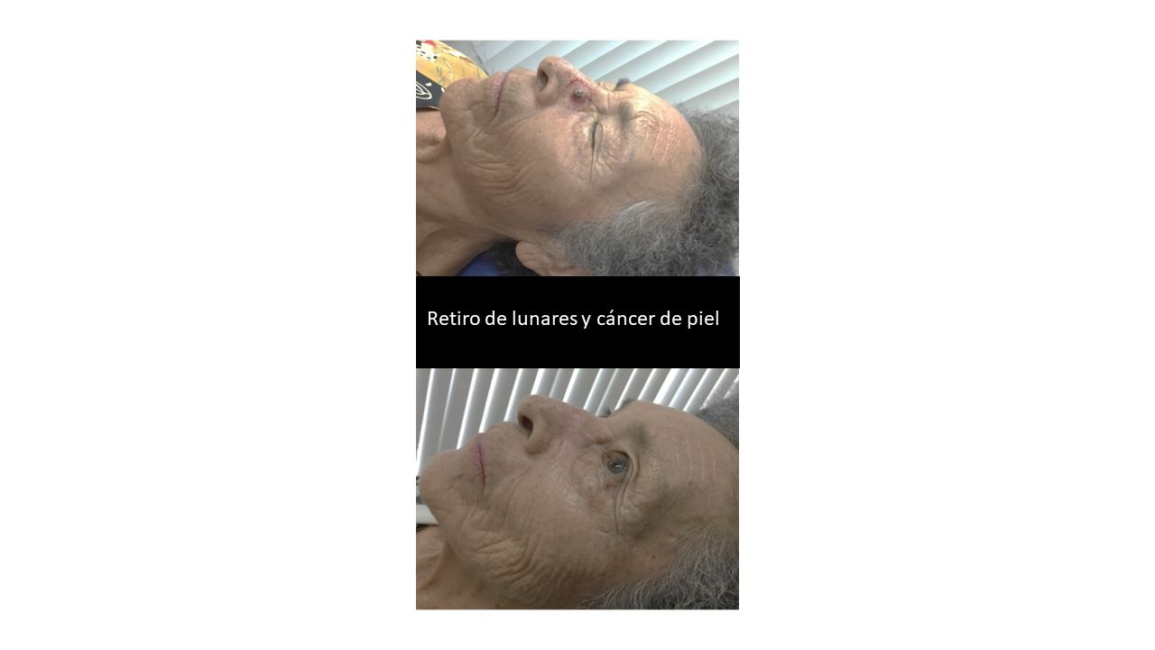 Médica Nápoles
