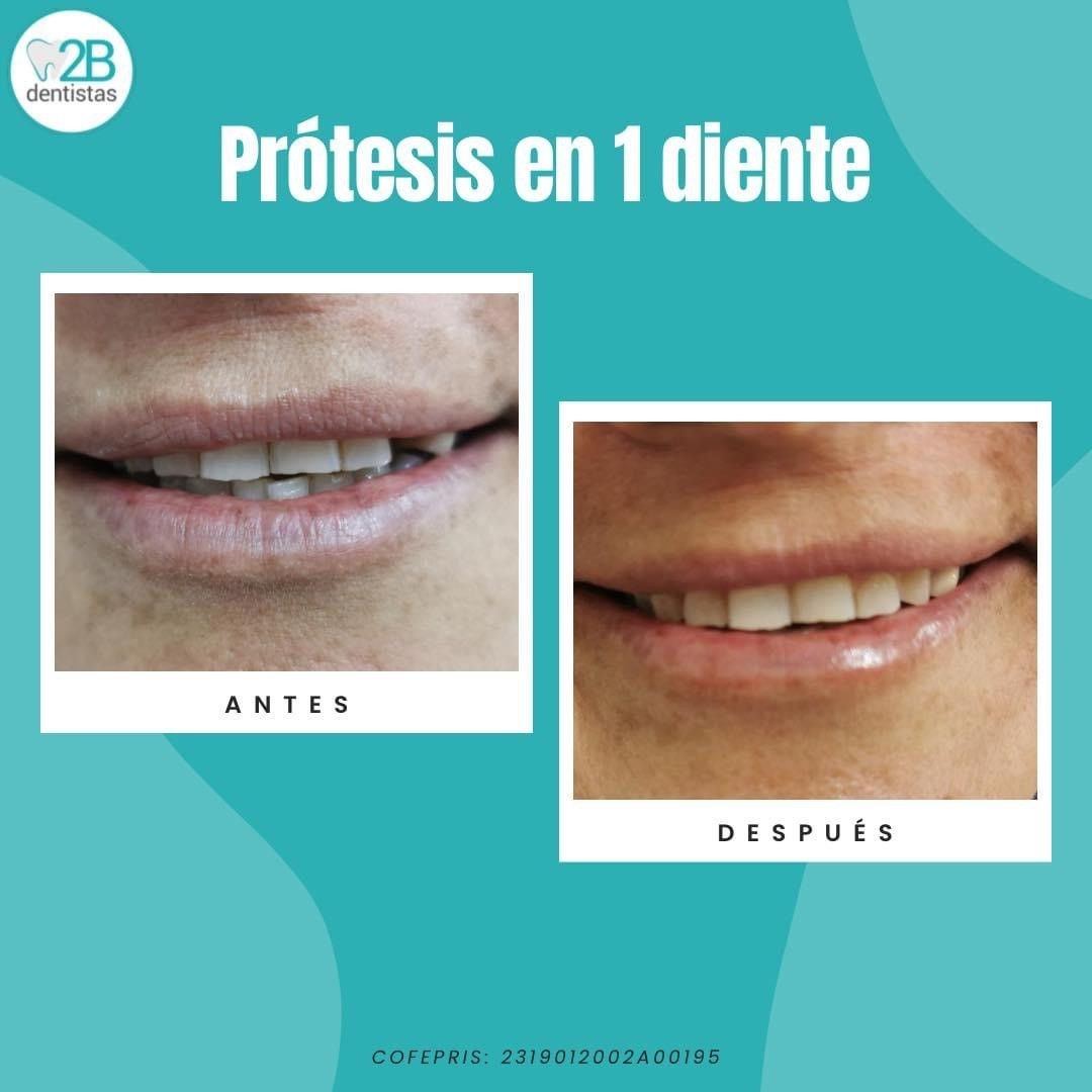 2b dentistas Dra Erika