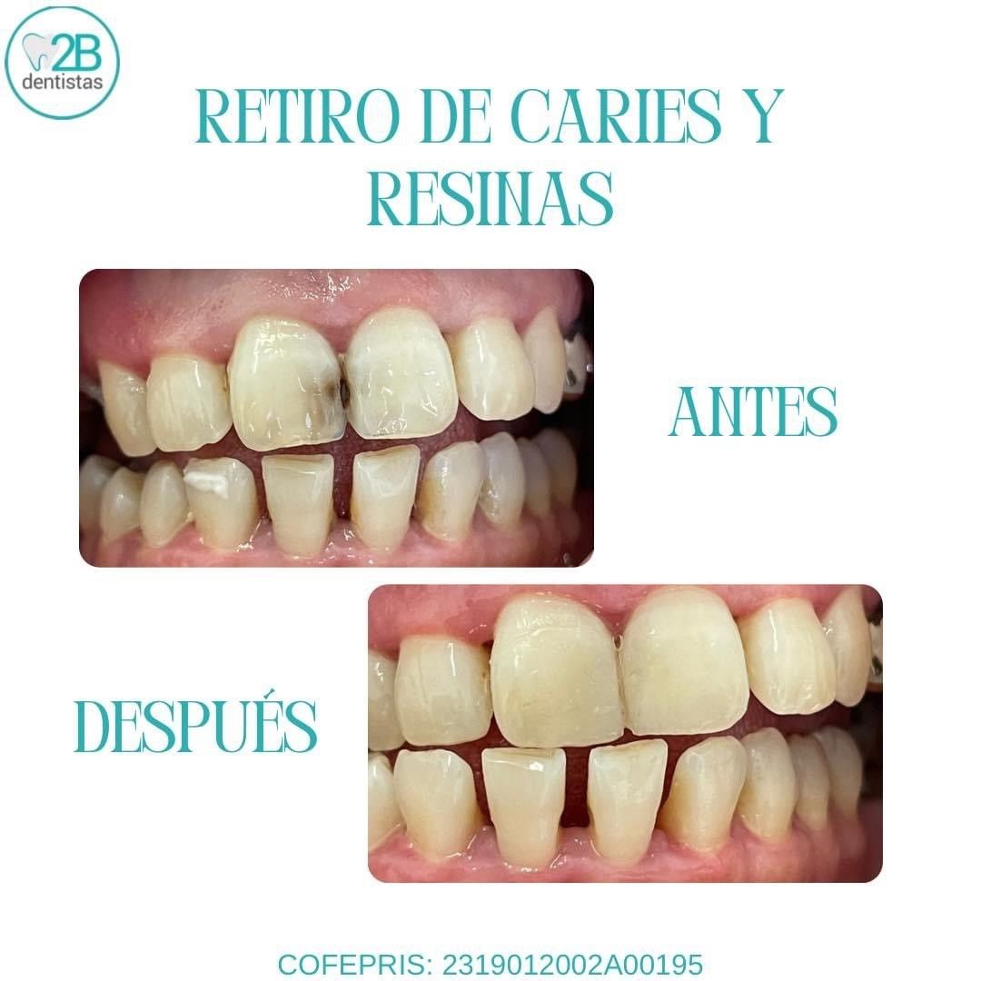2b dentistas Dra Erika — foto 2