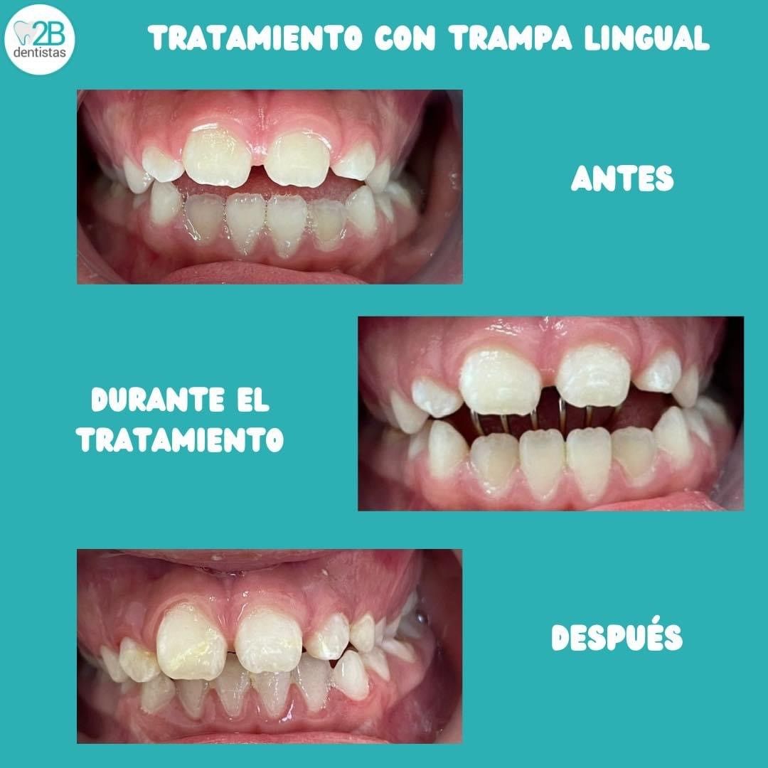 2b dentistas Dra Erika — foto 3