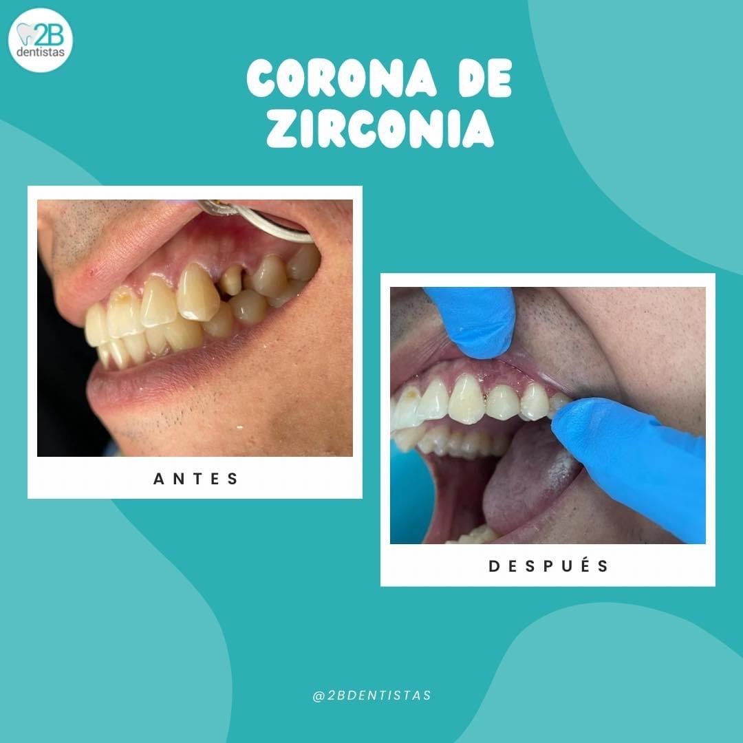 2b dentistas Dra Erika — foto 4
