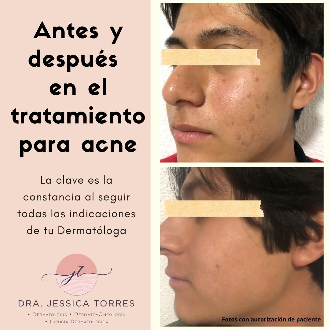 Dra. Jessica Torres Haro — foto 4
