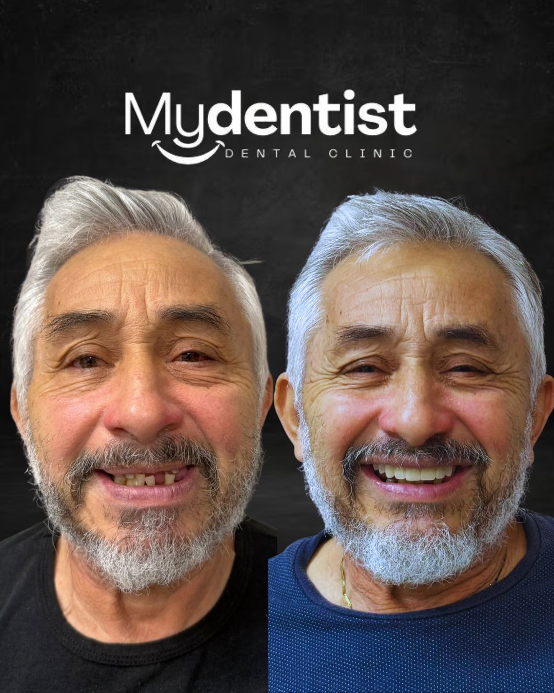 MYDENTIST