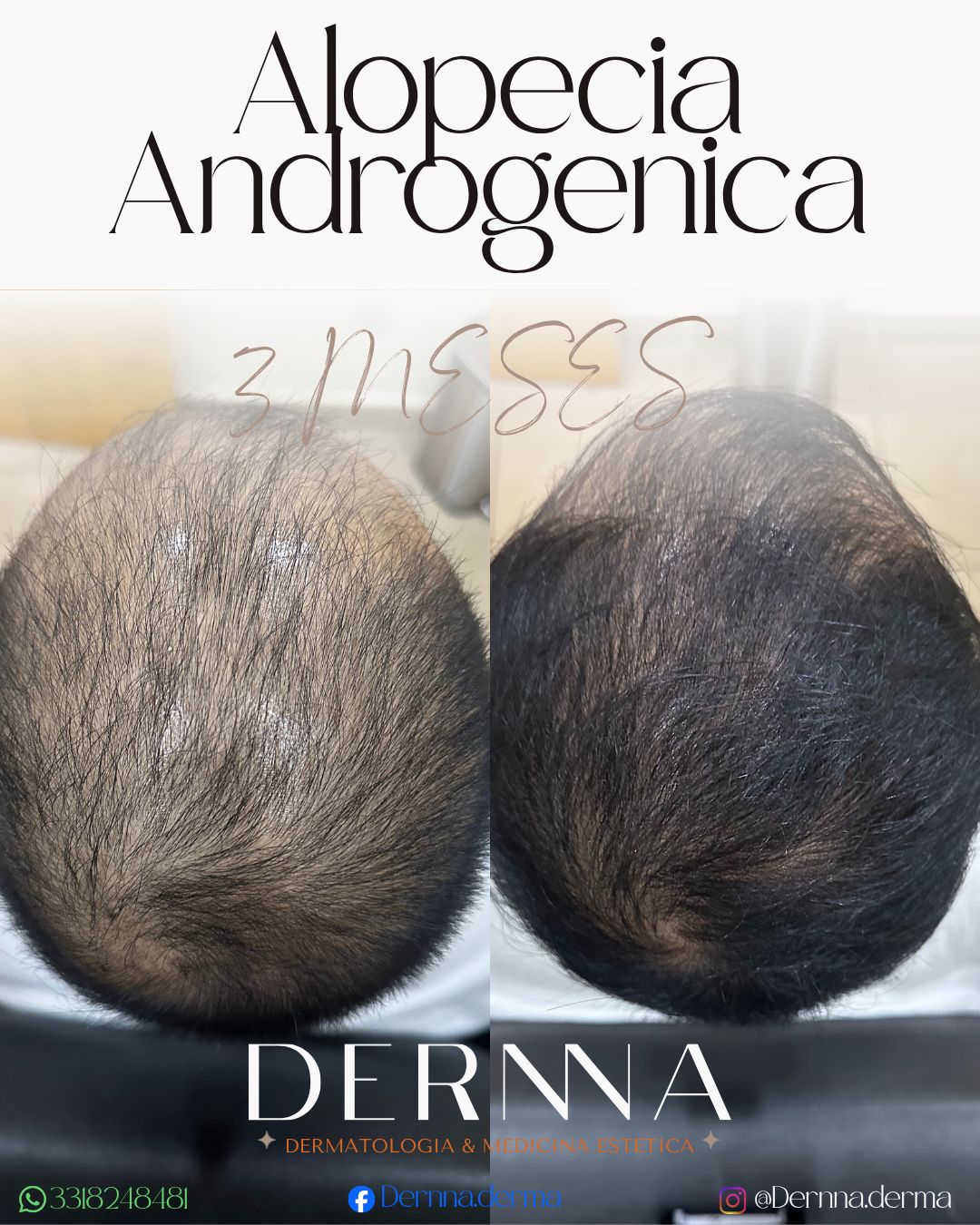 Mazamitlla Dernna
