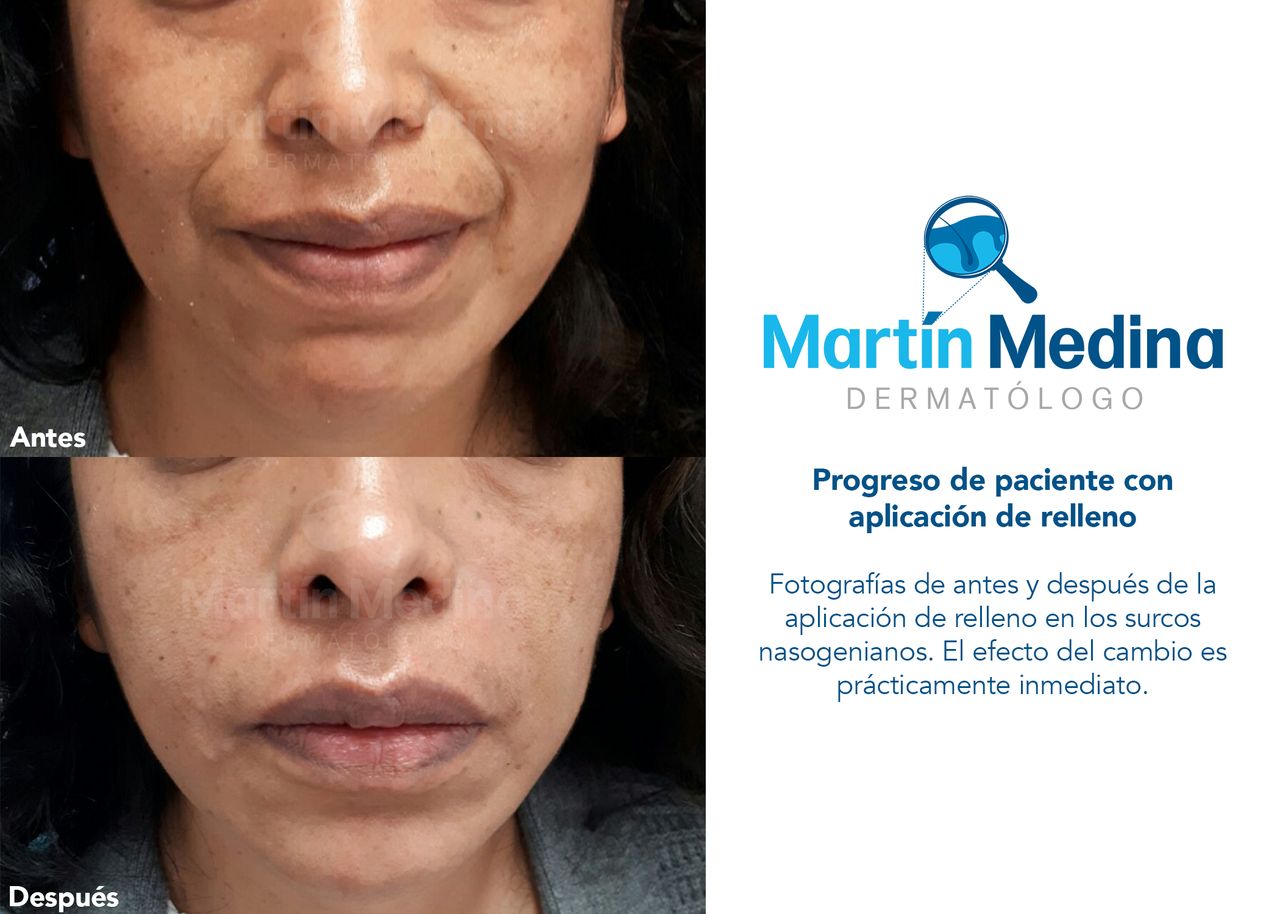 Dr. Jose Martin Medina Flores — foto 2