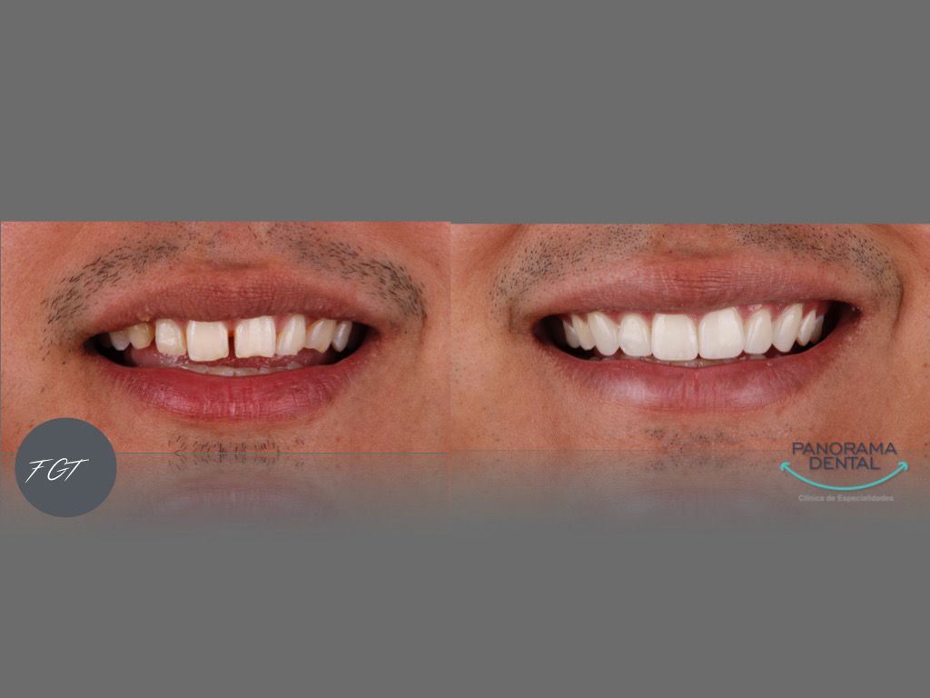 Panorama Dental Leon