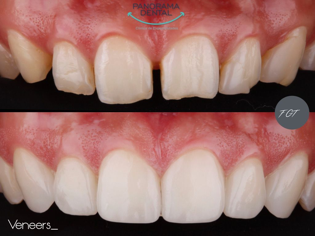 Panorama Dental Leon — foto 2