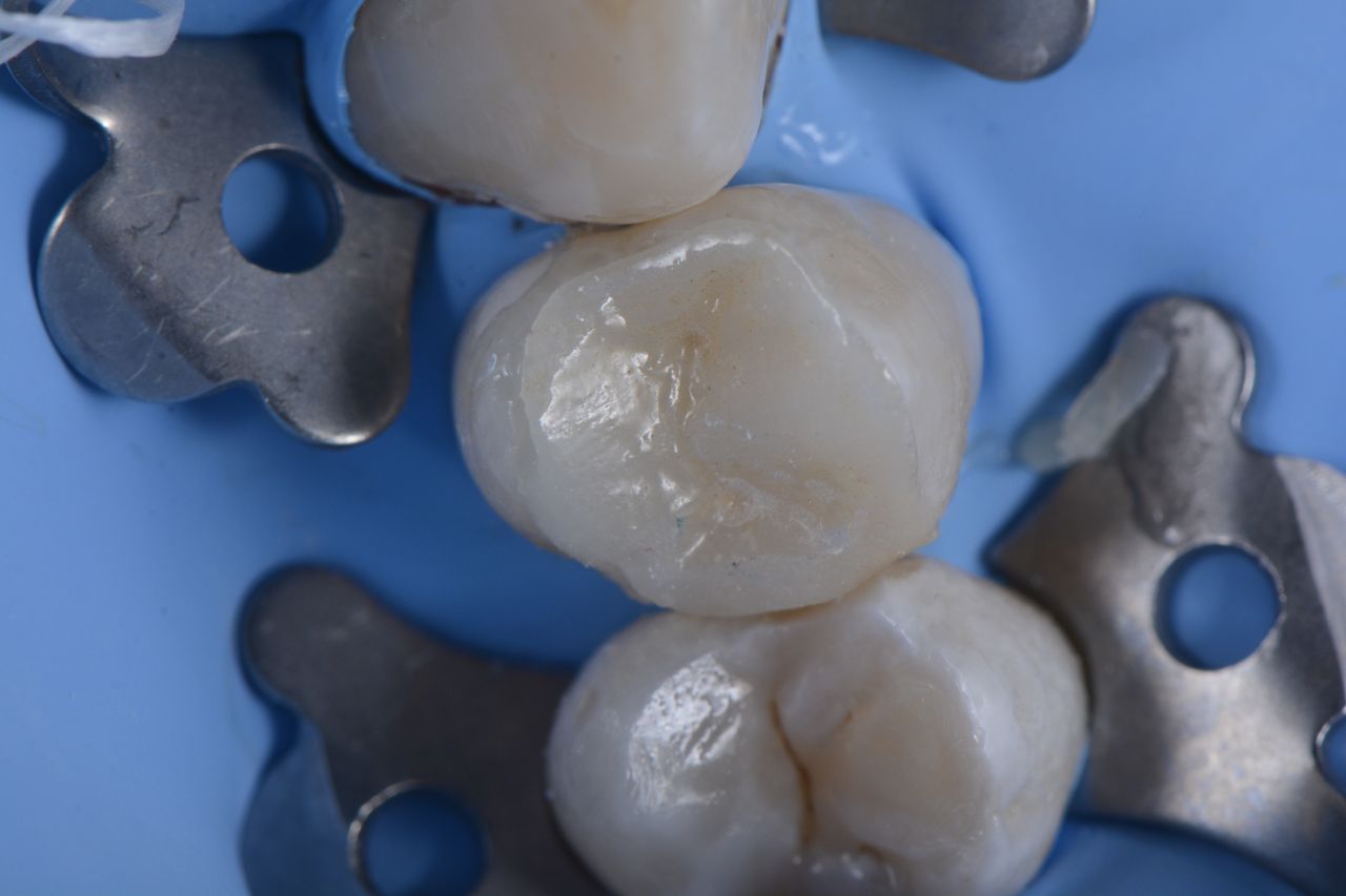 Panorama Dental Leon — foto 4