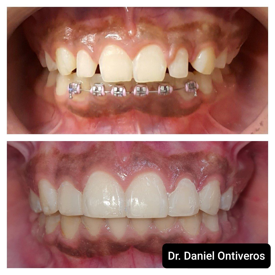 CLINICA DENTAL ORTODONCIA Y ENDODONCIA — foto 2
