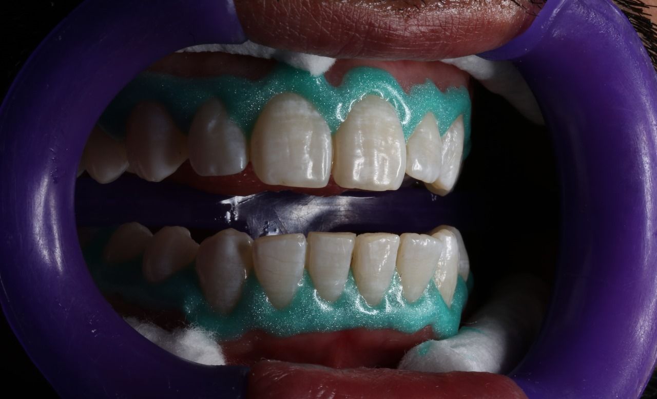 Molarz Dental Studio — foto 3