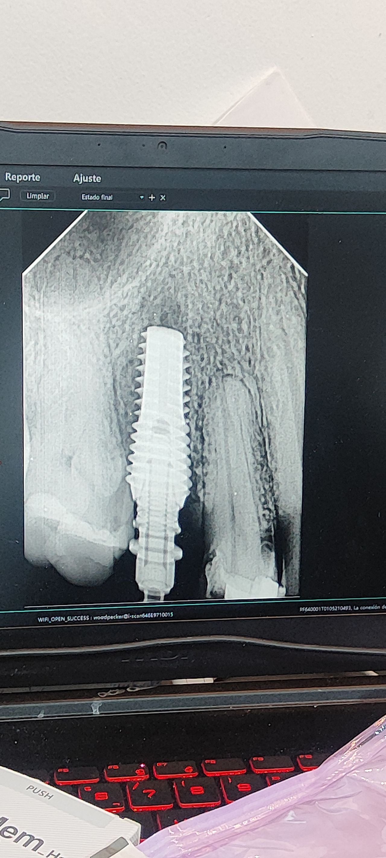 DENTAL ROOTS — foto 2