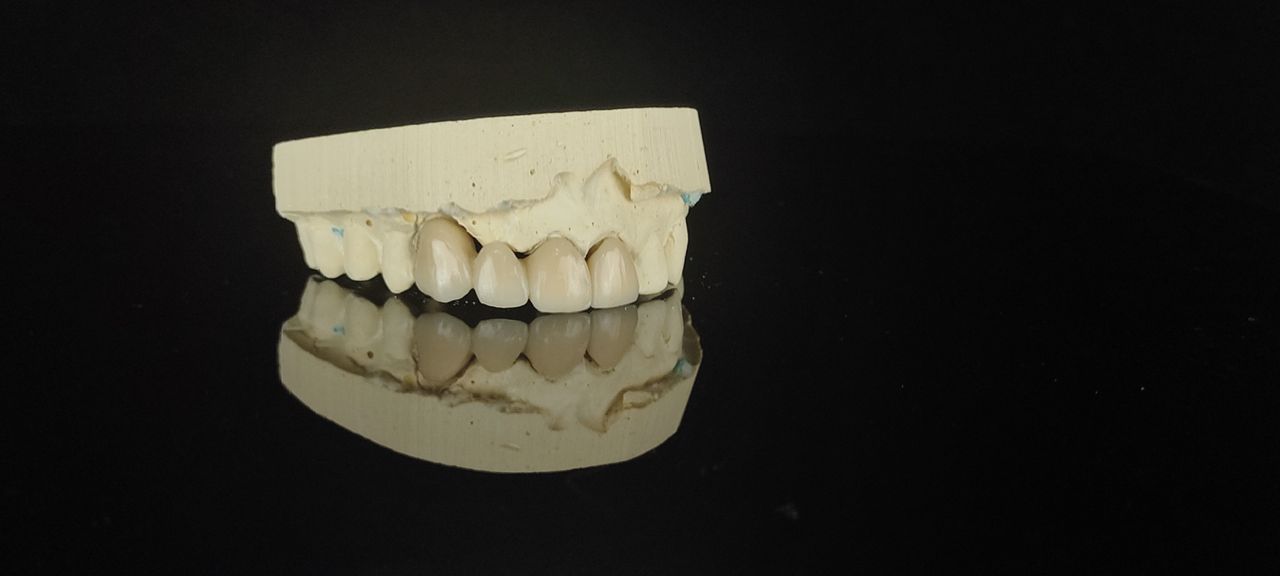 DENTAL ROOTS — foto 3