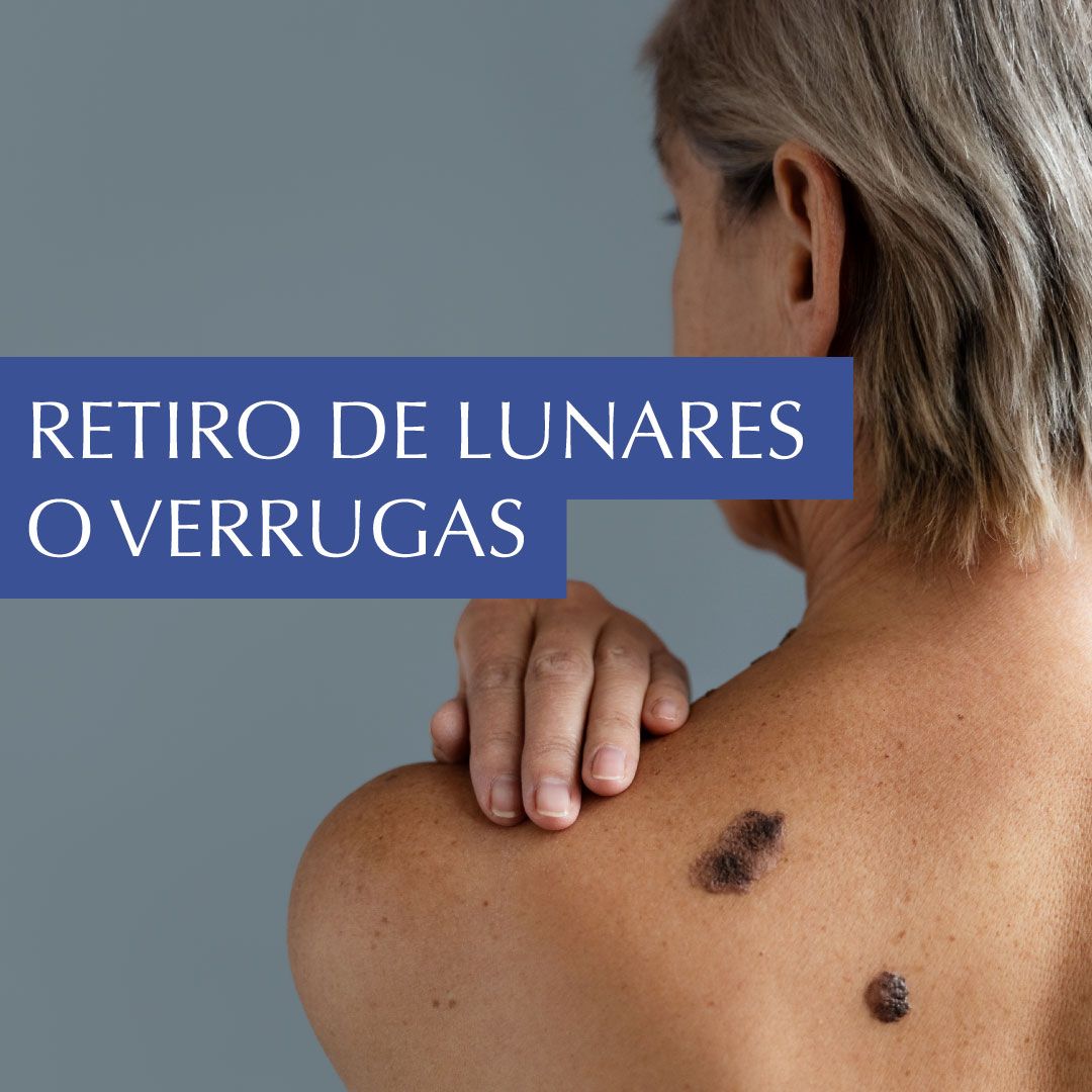 Dermat Chepevera — foto 3