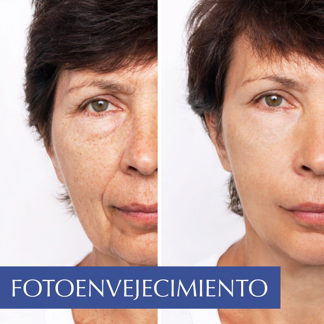 Dermat Chepevera — foto 4