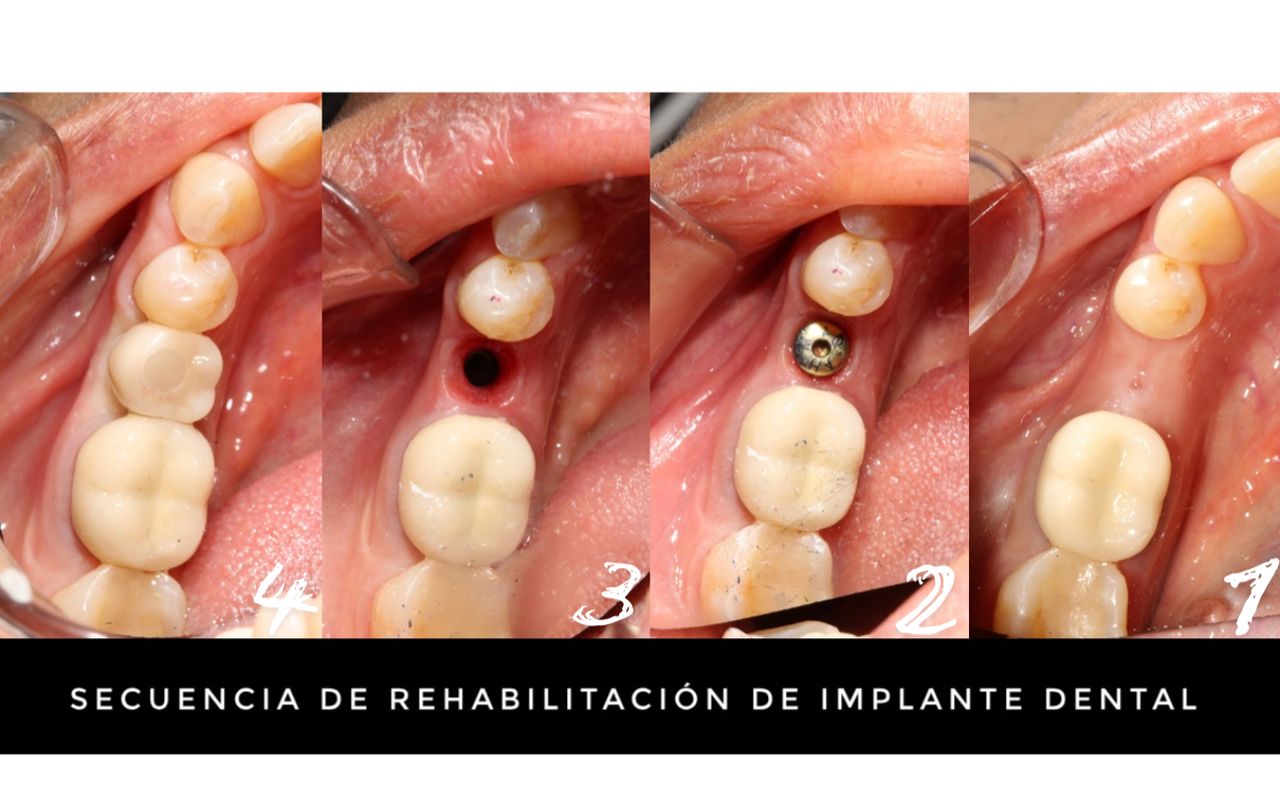 Bitehaus Dental Consultorio Dental — foto 2