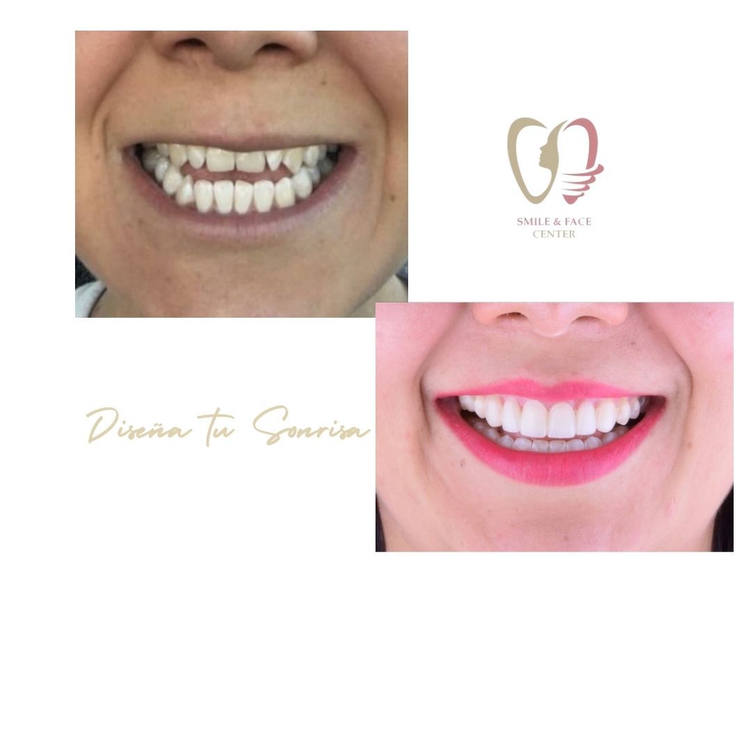 Smile & Face Center
