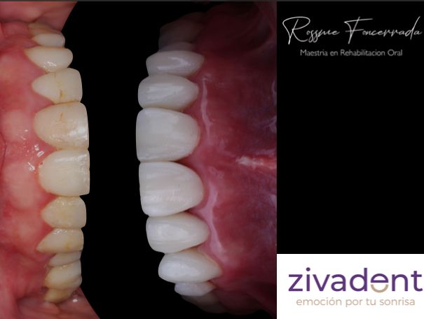 Rehabilitacion oral — foto 2