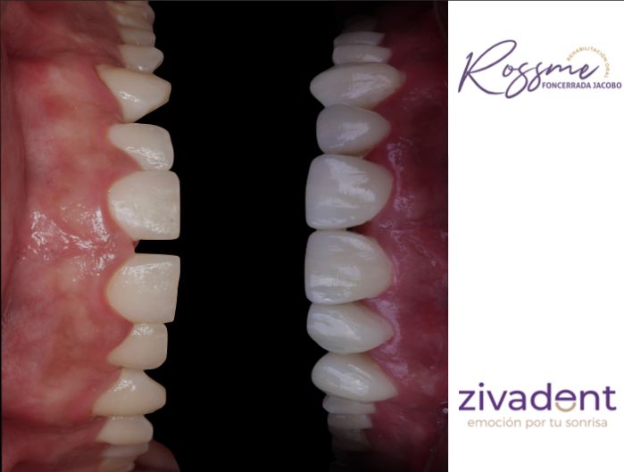 Rehabilitacion oral — foto 3