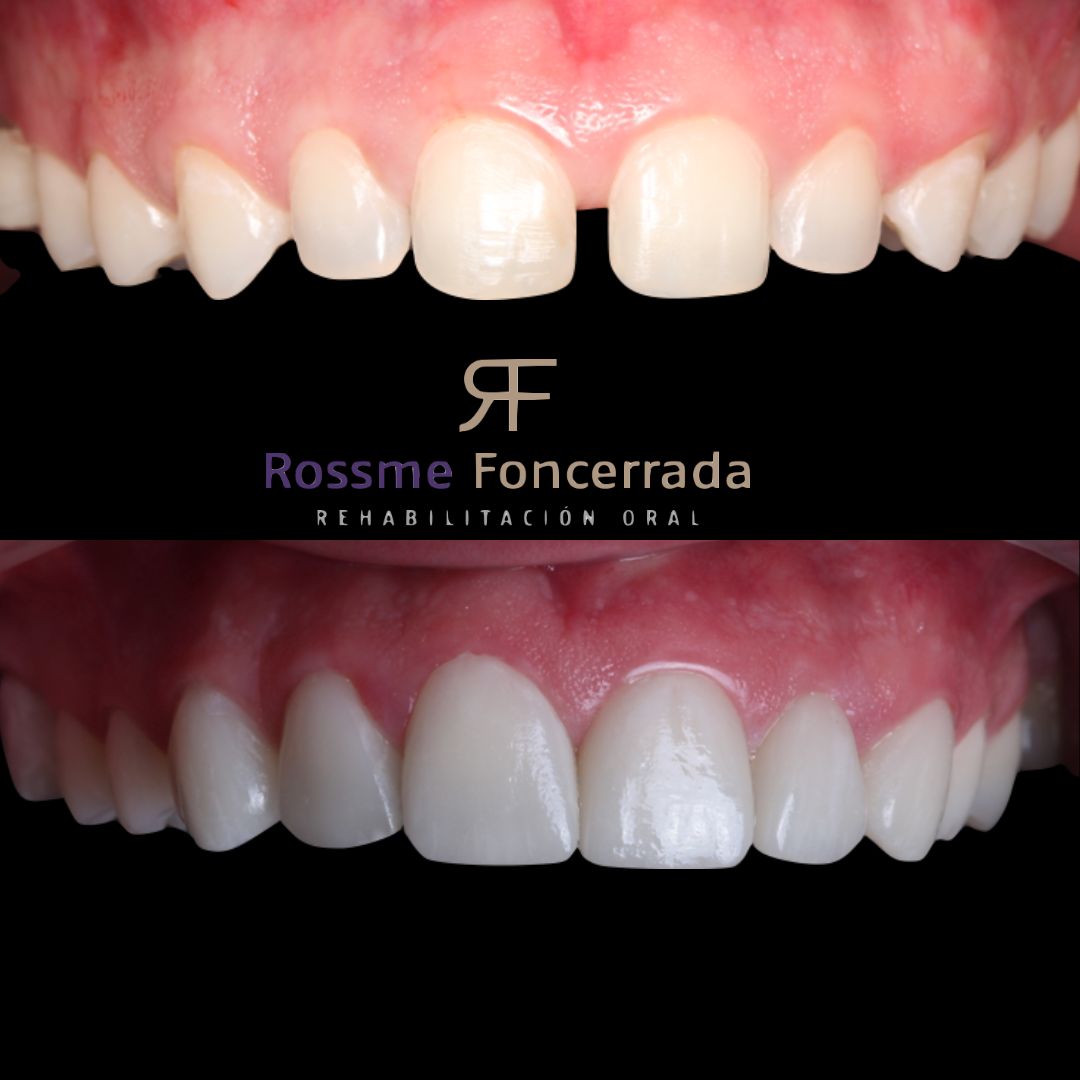 Rehabilitacion oral — foto 4