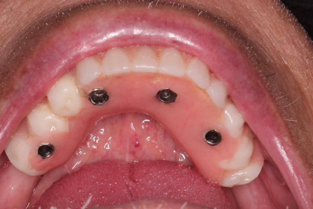 Sm4 Smile Method For All — foto 2