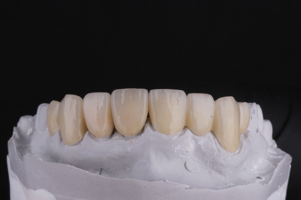 Sm4 Smile Method For All — foto 3