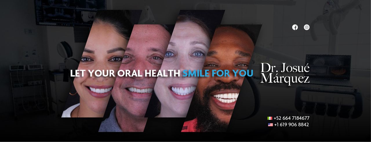 Sm4 Smile Method For All — foto 4