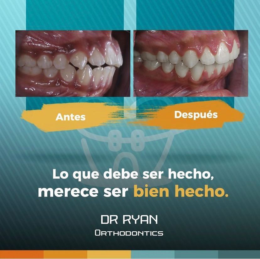 Ryan Michael Brenes Pacheco — foto 4