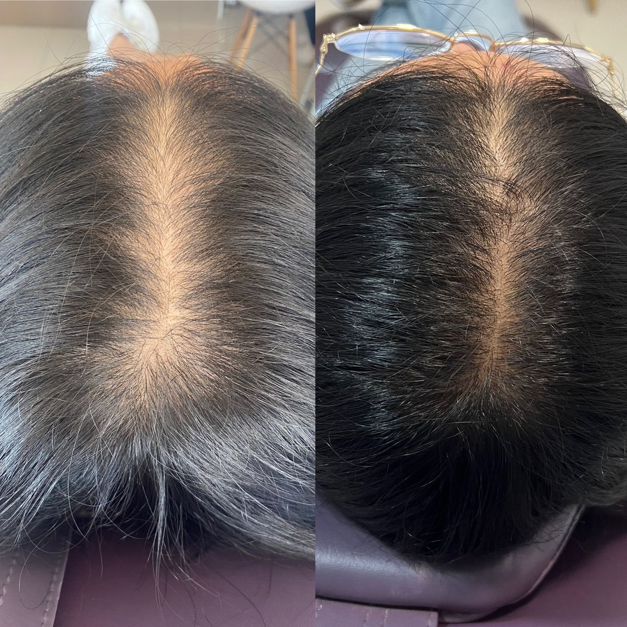 BARIDERM — foto 2