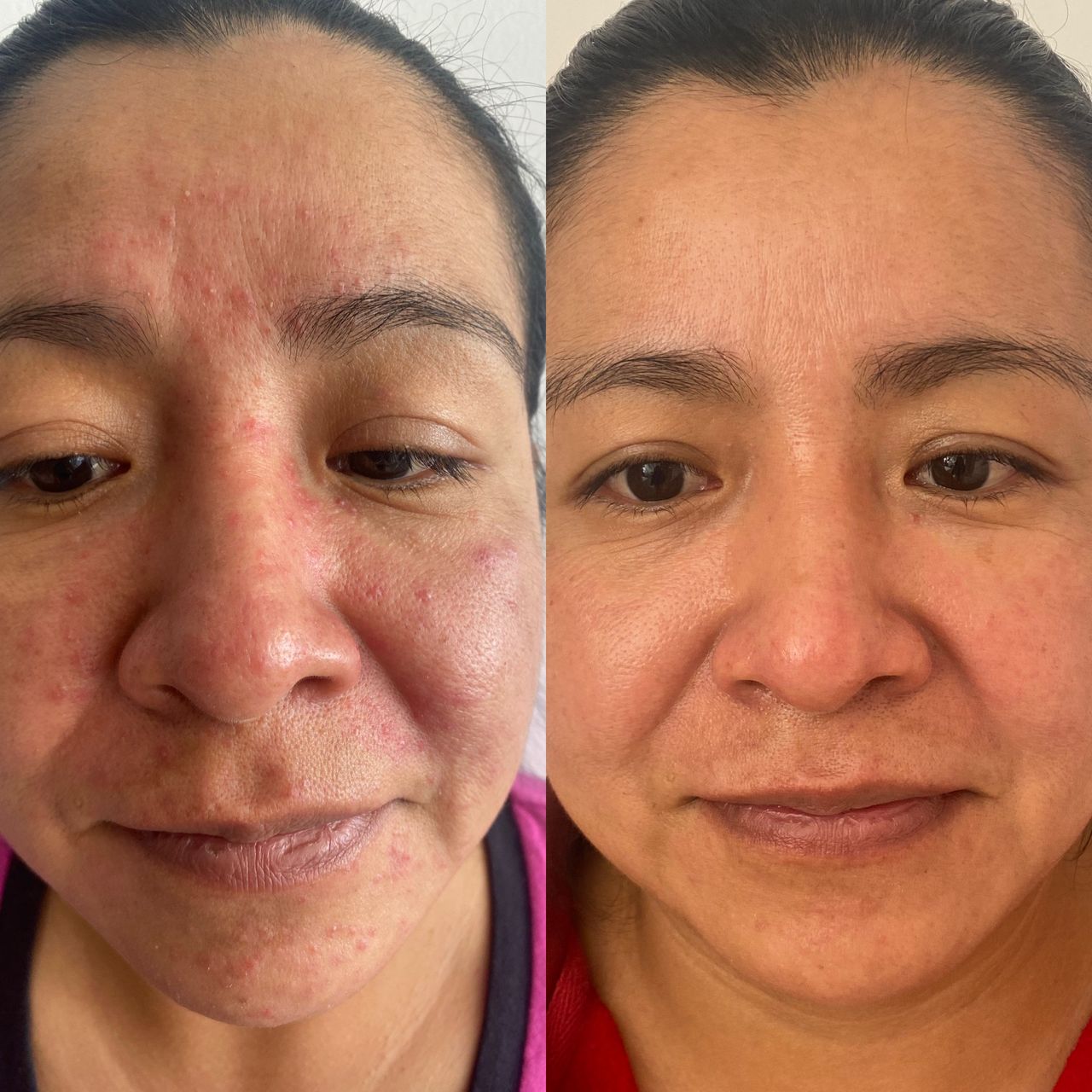 BARIDERM — foto 3