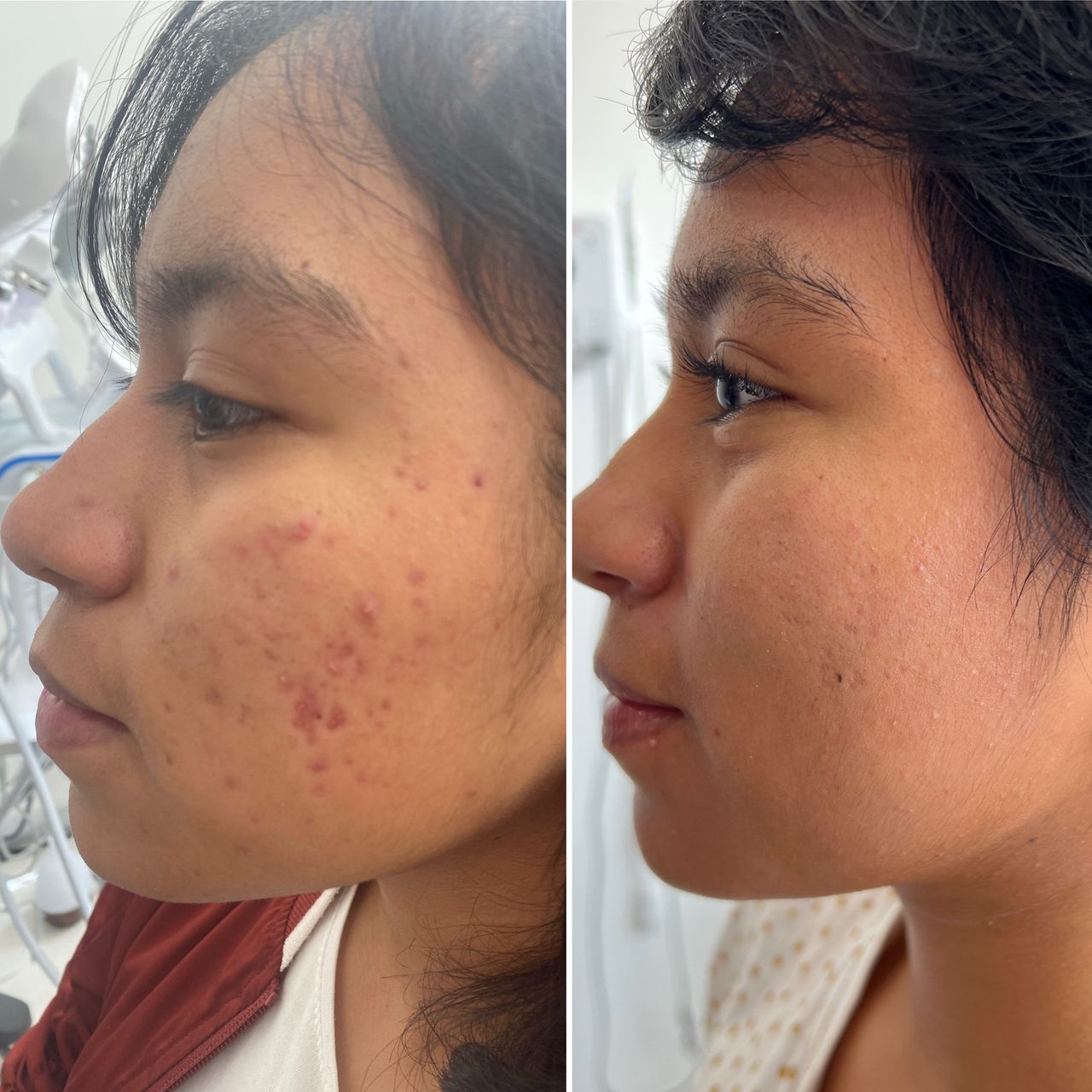 BARIDERM — foto 4