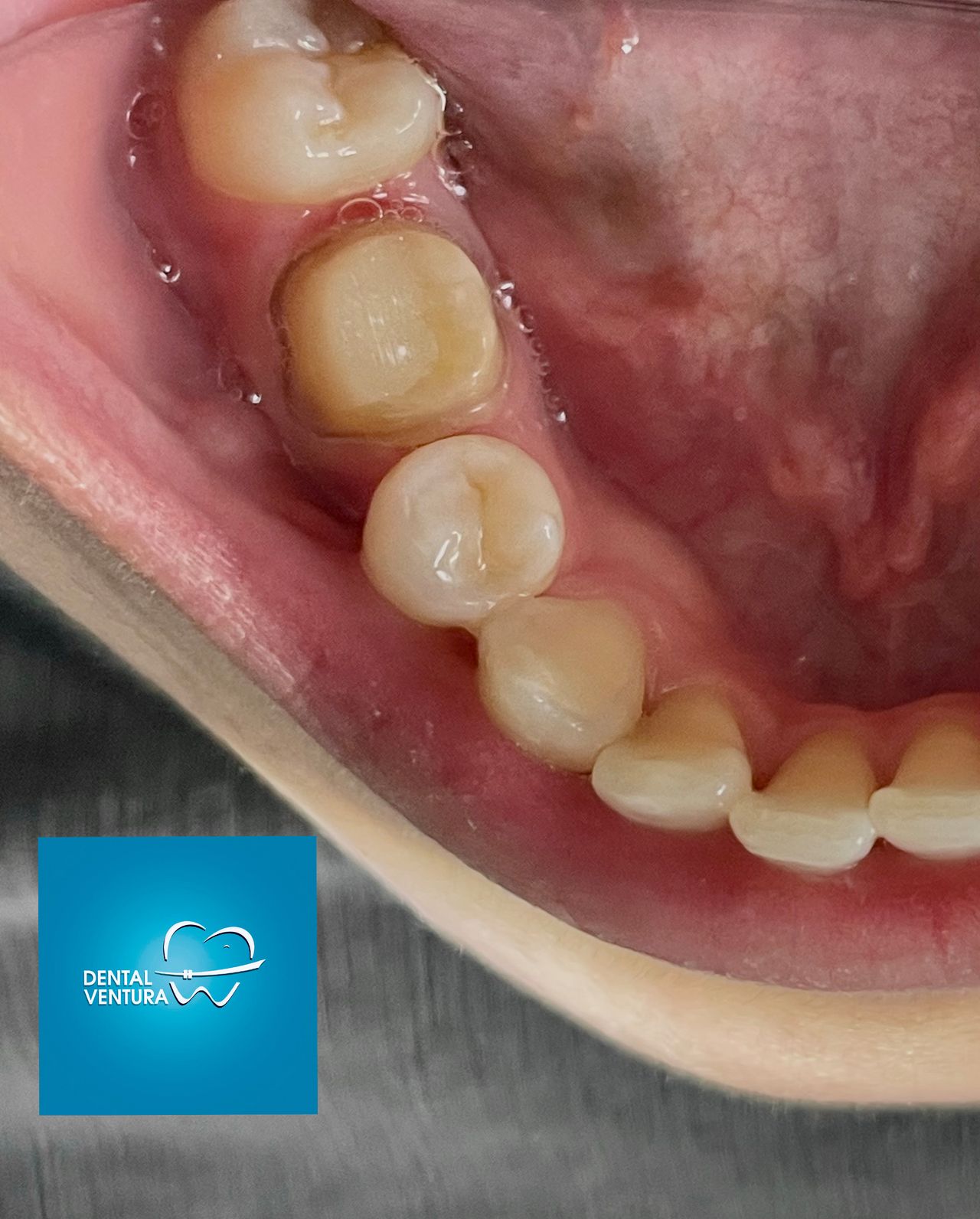 Dental Ventura — foto 2