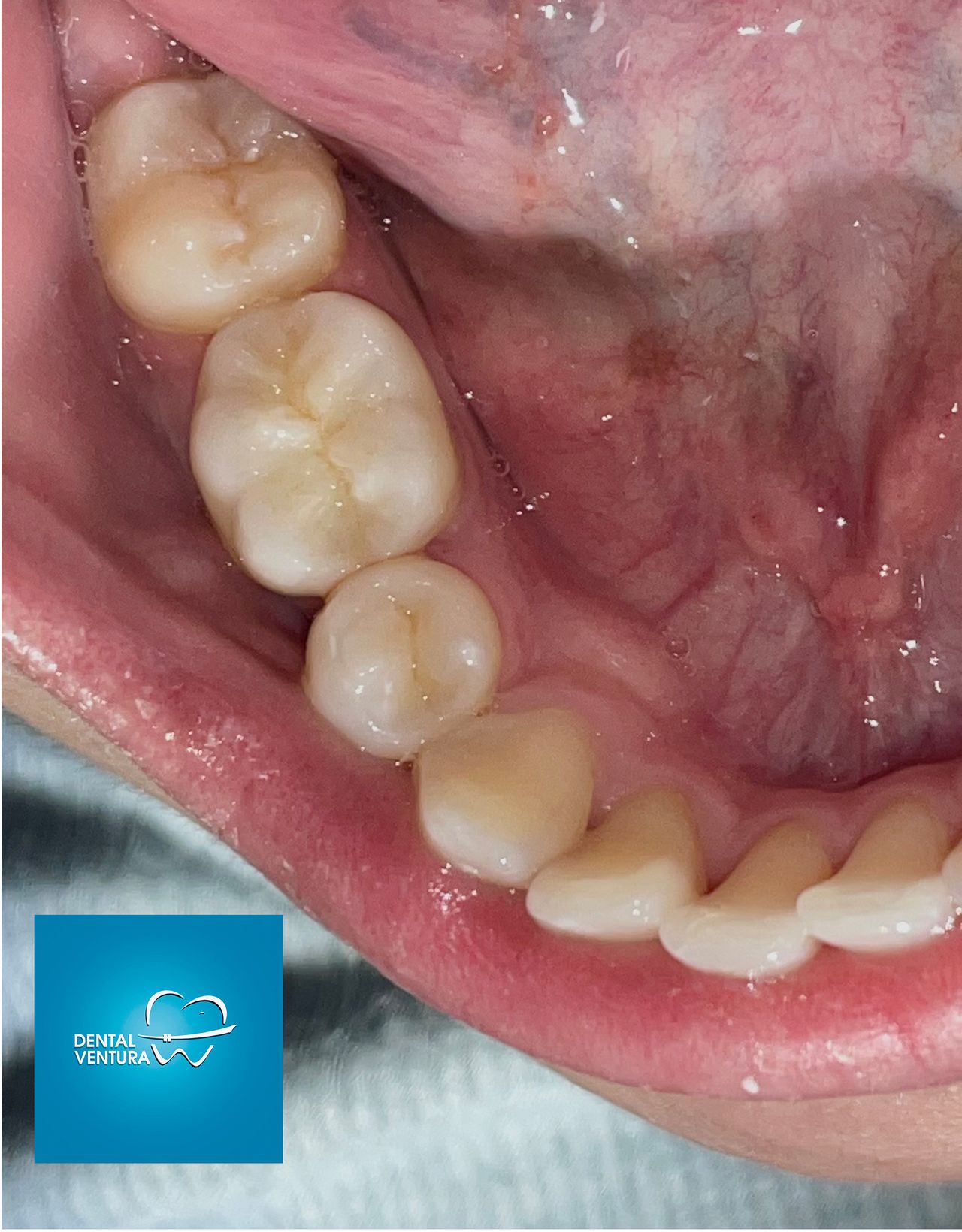 Dental Ventura — foto 3