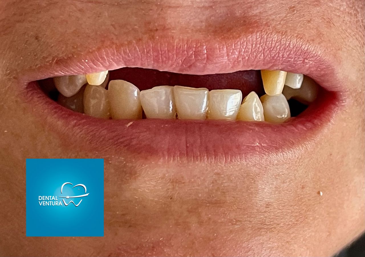 Dental Ventura — foto 4