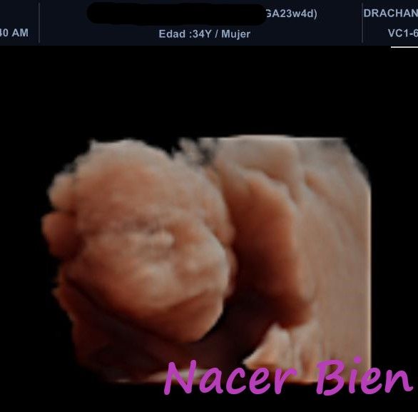Nacer Bien — foto 4
