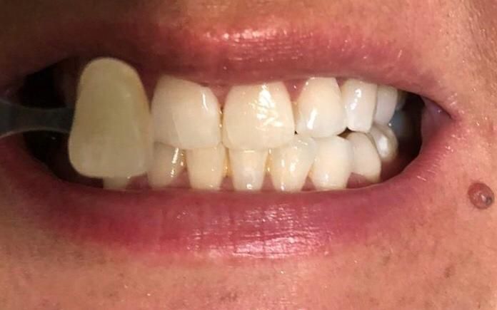 CONSULTORIO DENTAL DR. ENRIQUE FUENTES MERE — foto 2