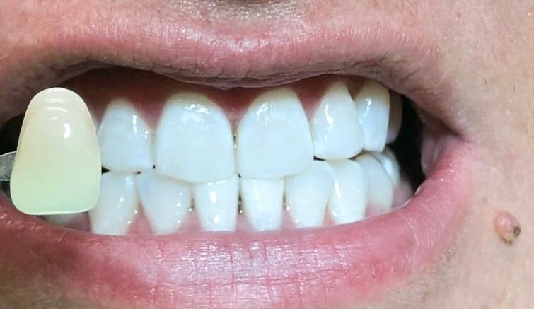 CONSULTORIO DENTAL DR. ENRIQUE FUENTES MERE — foto 3