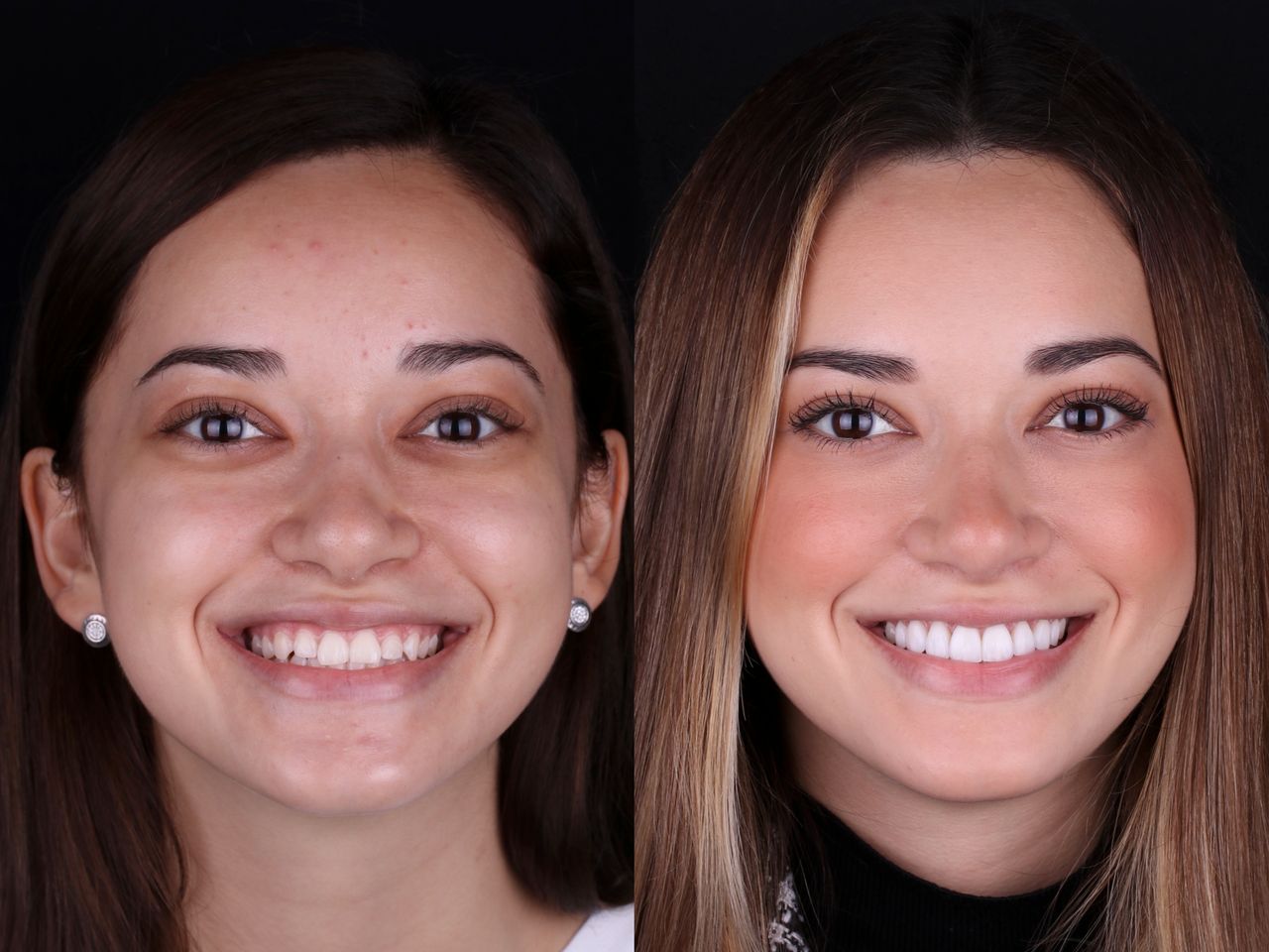 Zental Odontologia Cumbres (Plaza Sikara Distrito Urbano)