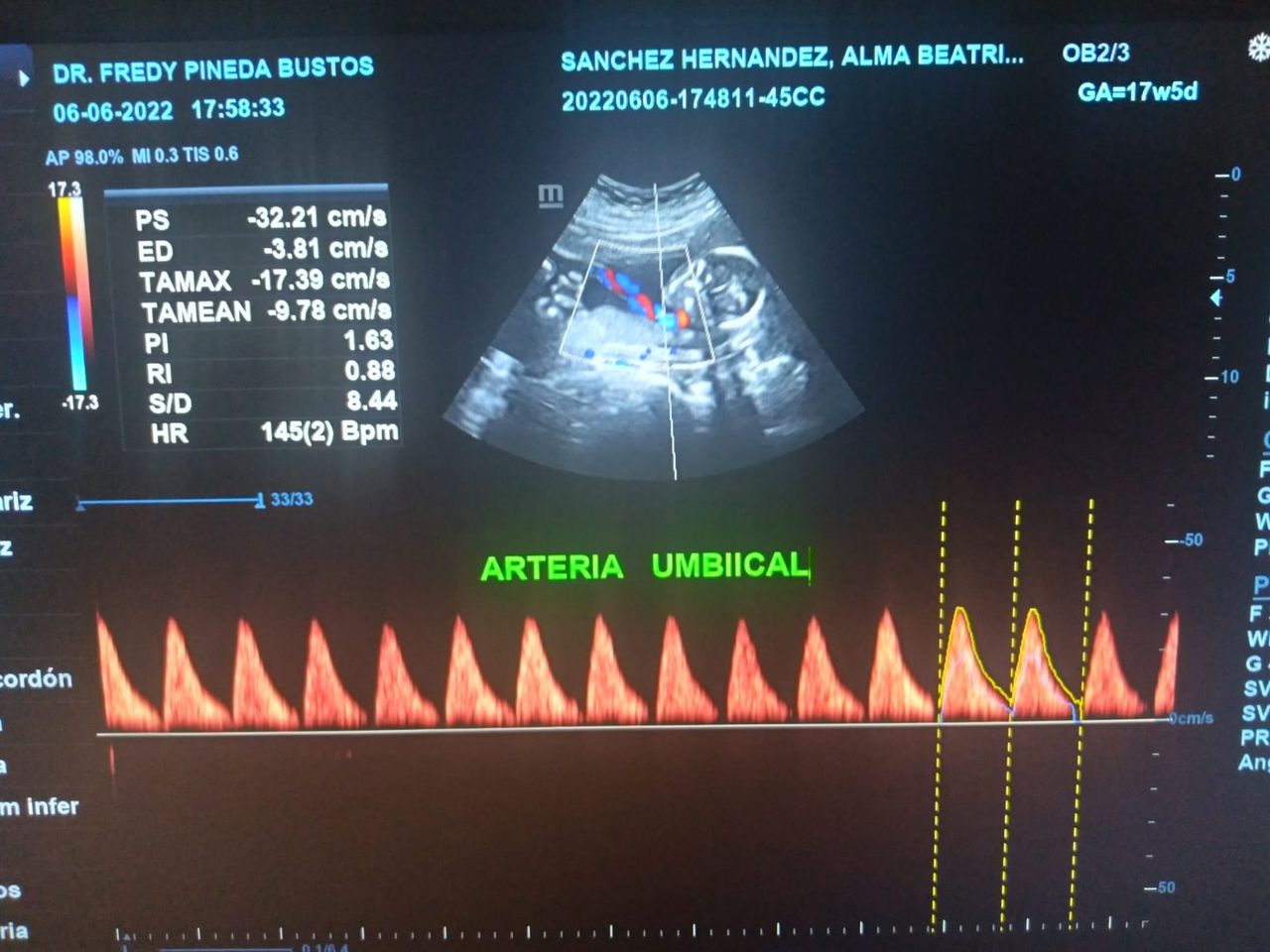 Dr. Fredy Pineda Bustos — foto 2