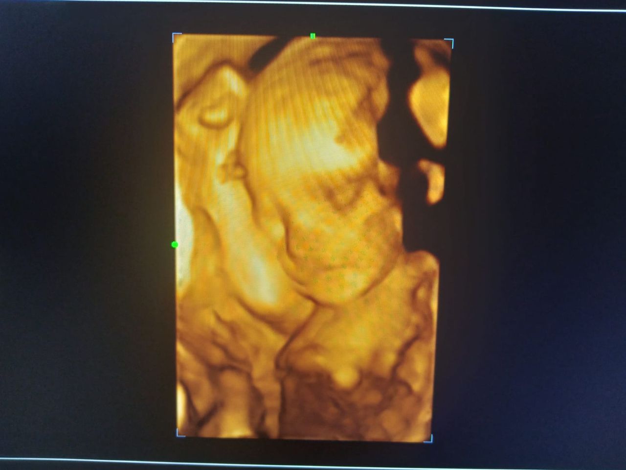 Dr. Fredy Pineda Bustos — foto 3