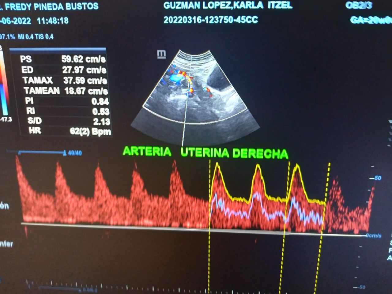 Dr. Fredy Pineda Bustos — foto 4